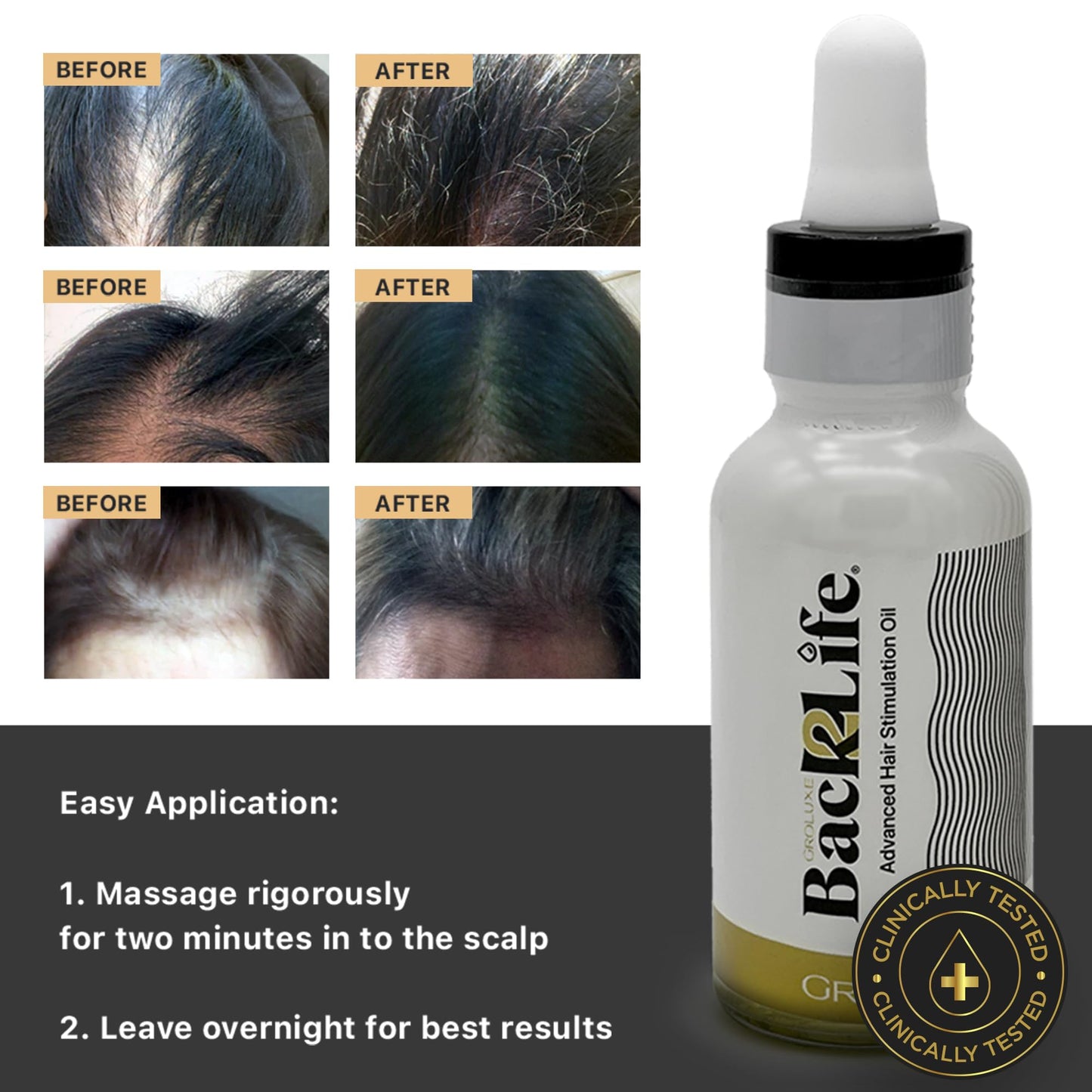 Back2Life 100% Natural Hair Stimulation & Beard Growth Oil-Get Rid of Patchy Beards & Hair-Beard serum to Moisturise, Hydrate & Condition-Repair & Rebalance Your Scalp & Regrow your Head & Beard Hair