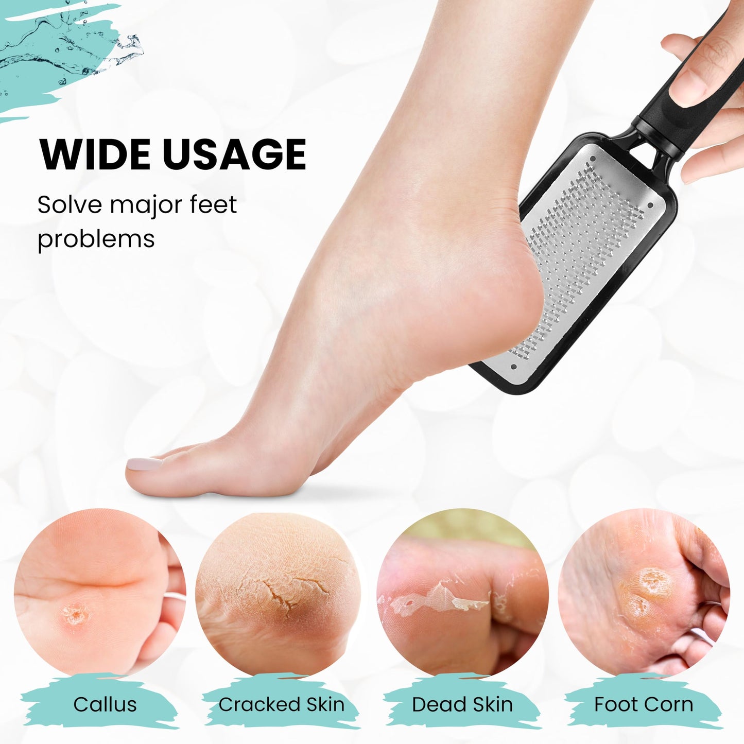 3-in-1 Professional Pedicure Foot File for Hard Skin - Anti Rust Stainless Steel Callus Remover for Cracked Heels - Easy to Use & Anti Skid Design - Foot Care Tool for Dry and Dead Skin - BNS Flower White